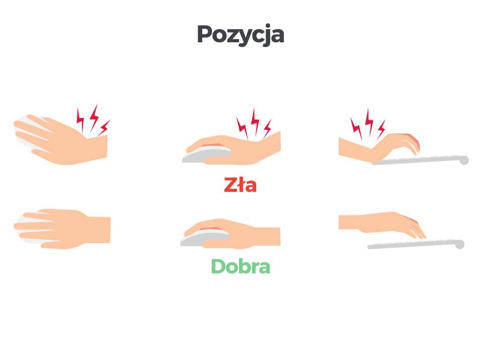 Cieść nadgarstka