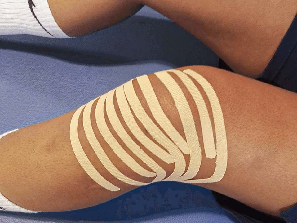 Taping limfatyczny
